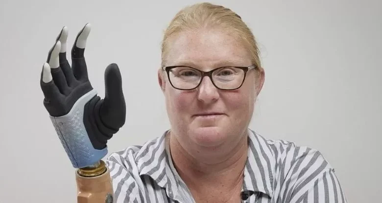 این دست بیونیکی سیگنالهای مغز را به حرکات دقیق تبدیل میکند + ویدیو 1 ROBO.jpg.webp