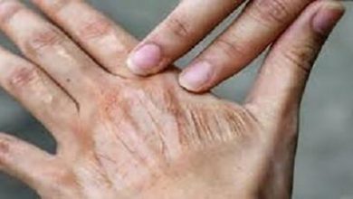 اشتباه‌های رایج در مراقبت روزانه از پوست که مرتکب آن می‌شوید