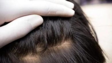 برای خلاصی کودکتان از شپش این کار را کنید