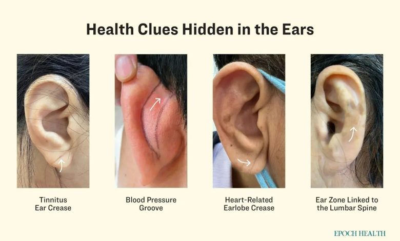 مزایای ماساژ گوش برای بدن که از آن بی منفعت مانده اید_اسپایدر 1  سرنخهای پنهان سلامتی در گوش