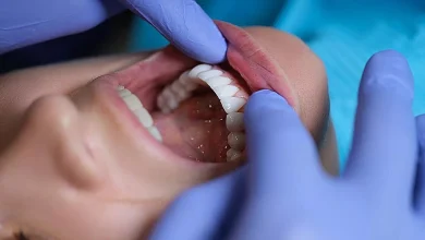 بیماری لثه امکان پذیر خطر سکته مغزی را افزایش دهد_اسپایدر 3 gum disease may raise.jpg.webp